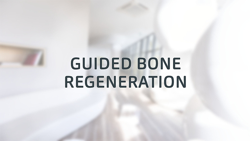 Guided Bone Regeneration